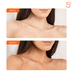 05-antes-e-depois--4-